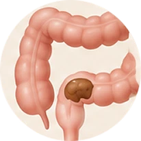 Colon: Adds Soft Bulk